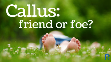 Calluses: Friend or Foe?