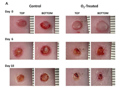 Low flow oxygenation of full-excisional skin wounds on diabetic mice improves wound healing by accelerating wound closure and reepithelialization
