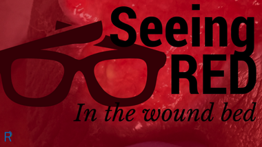 Seeing Red In The Wound Bed
