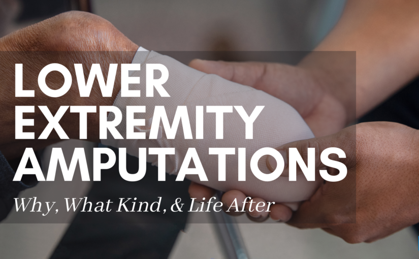 Lower Extremity Amputations: Why, What Kind, & Life After